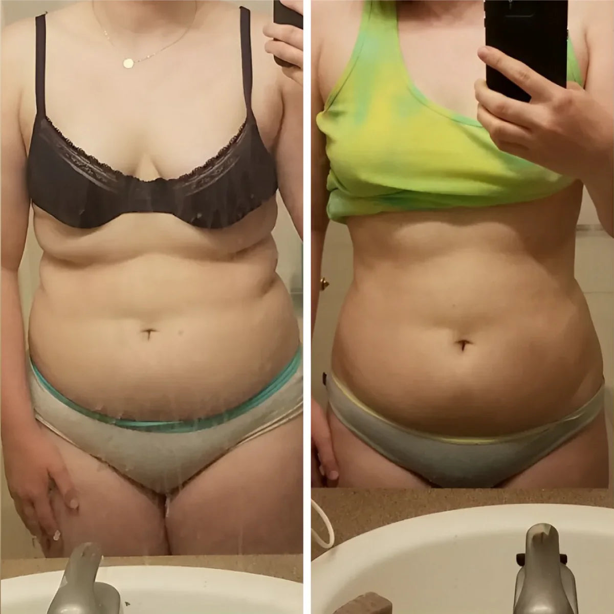 Before and after for Glorivee