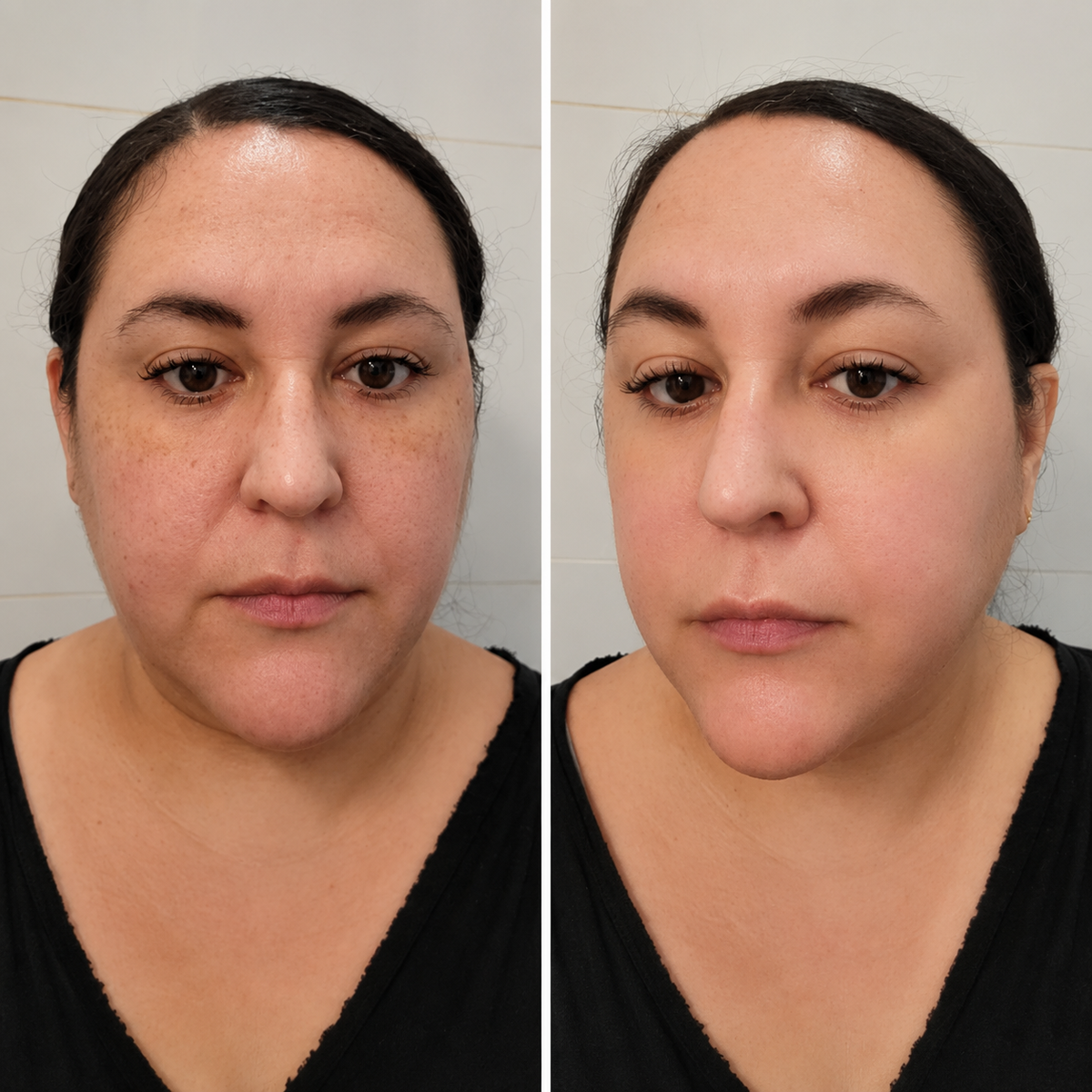 Before and after for Emma